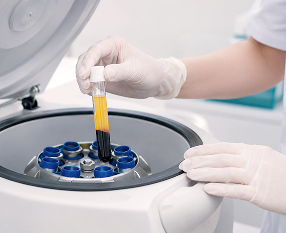 LANTE OBGYN Intimate PRP / O-Shot in Gangnam, Seoul